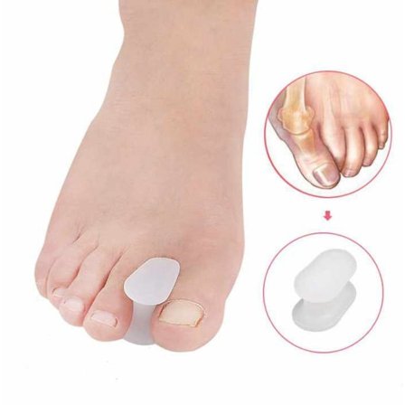 2-Pack - Hallux Valgus Isovarpaan erotin