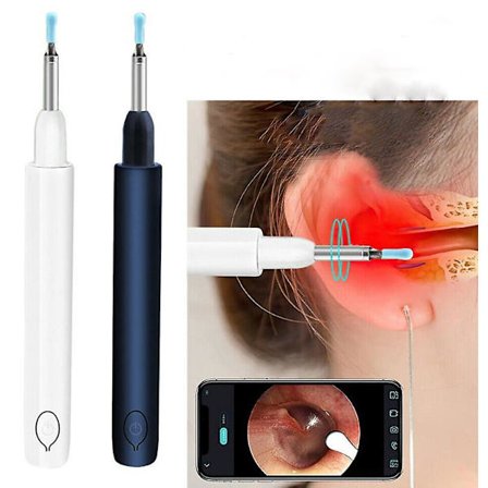 Öronrengöringsverktyg LED-ljus skopa plocka kamera rengöring öronvax remover(Vit)