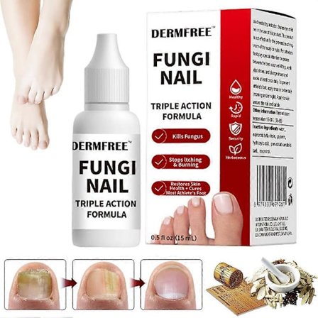 15 ml Fungi Nail Treatment Væske Hurtigvirkende Neglereparasjon Styrkende Væske Neglepleieutstyr[HK]