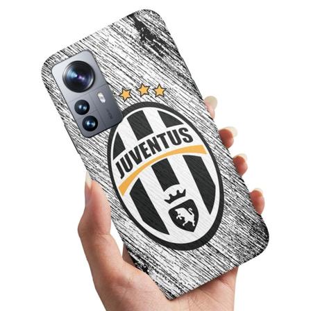 Xiaomi 12t/12t Pro - Skal Juventus