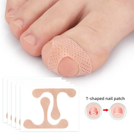 Tåkorrektionsplaster til nedgroede negle