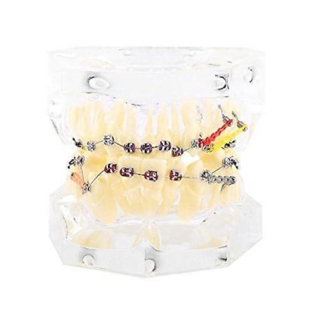 Tandmodell för utbildning, dental ortodontisk behandling, malocklusion, studiedemonstration, tandmodell med trådkedja, orange