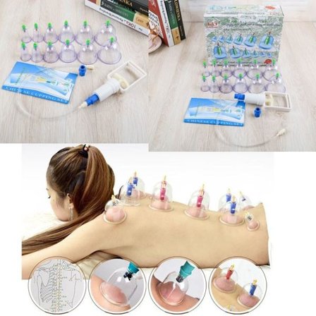 12 stk Vakuum Kopper Relax Massasje Kopper Sett