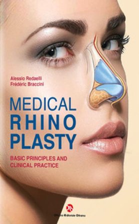 Medical rhinoplasty. Basic principles and clinical practice Alessio Redaelli