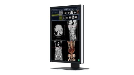EIZO RadiForce RX270 - LCD-skjerm - 2MP - farge - 21.3"