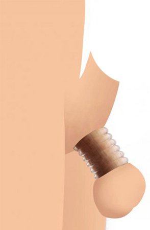 Master Series Ring Master Custom Ball Stretcher Kit - Woome.pl