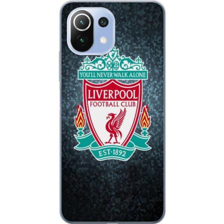 Xiaomi 11 Lite 5G NE Kuori / Matkapuhelimen kuori - Liverpool