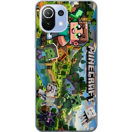 Kompatibelt Mobildeksel til Xiaomi 11 Lite 5G NE Lady Gaga The Fame svartvit portrett med store solbriller i minimalistisk pop estetikk