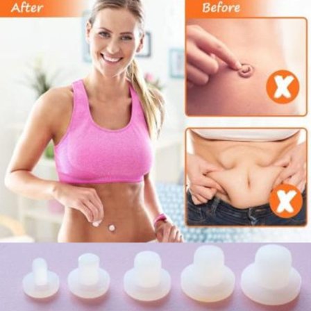 5-pack Navelpluggar för Efter Liposuction/Bukplastik