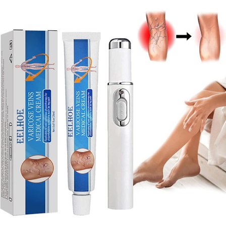 Veinshealth Åreknuter Blått Ljusterapi Set, Åreknuter Behandling Blått Ljus Laser Behandlings Penna, Åreknuter Kräm