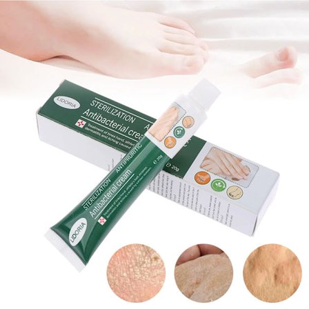 Kløestillende Tinea Pedis soppdrepende salve mint kjølende krem peeling eksem psoriasis fot hud erosjon medisinsk krem