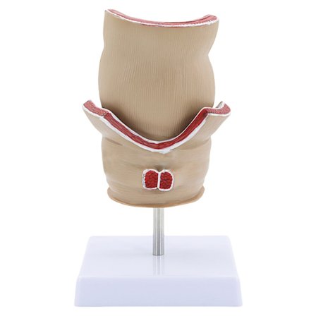 Modell av menneskelig rektum for anatomi Patologier av rektum Modell Medisinsk undervisningsmodell Utstyr for studier og utstilling
