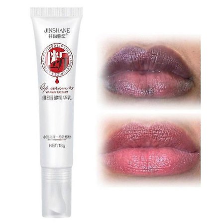 Leppeserum, Leppefukter, Leppelysning for mørke lepper, Mørke lepper, Lepper Frisk behandling Fjerner mørke lepper Leppepomade Fuktighetsgivende 