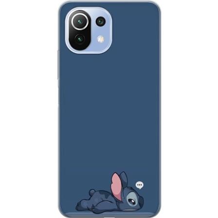 Xiaomi 11 Lite 5G NE Genomskinligt Skal Stitch ...