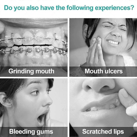 Kjeveortopedisk Voks Tannregulering Voks Med Smak 10-pakning, Dental Ortho Dots Voksstrimler For Aligners, Tannregulering