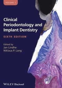 Clinical Periodontology and Implant Dentistry, ISBN: 9780470672488