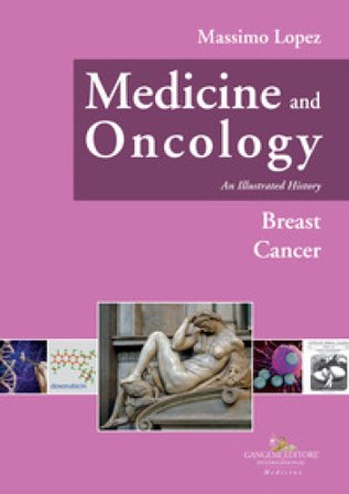 Medicine and oncology. An illustrated history. Vol. 8: Breast Cancer Massimo Lopez