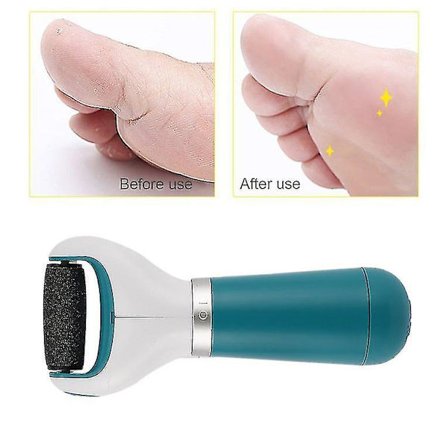 Sähköinen jalkojen hiomakone kuolleen ihon poistoon