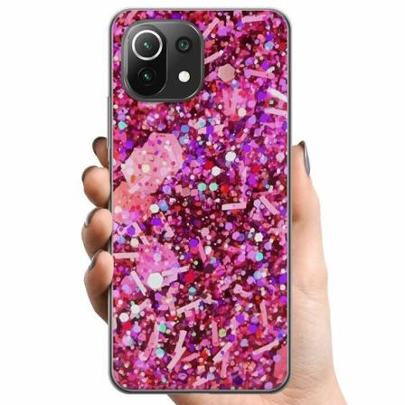 Xiaomi Mi 11 Lite Tpu Mobilskal Glitter