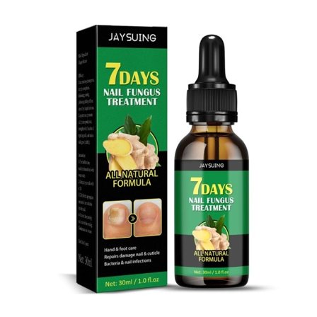 30 ml ingefær negle svamp behandling hånd fod pleje essens paronyki fjernelse svamp væske