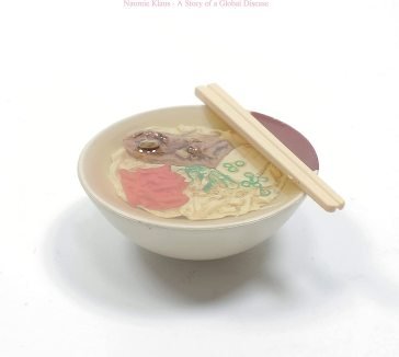 A story of global disease NAOMIE KLAUS