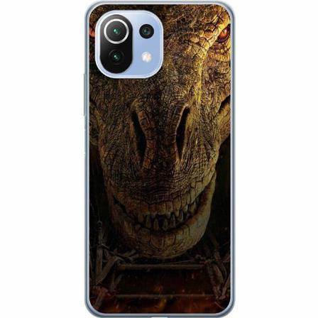 Xiaomi Mi 11 Lite Mjukt Skal - House Of The Dragon