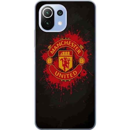 Kompatibelt Mobildeksel til Xiaomi Xiaomi 11 Lite 5G NE Manchester United logo i rød og gul farge med røff sportslig bakgrunn