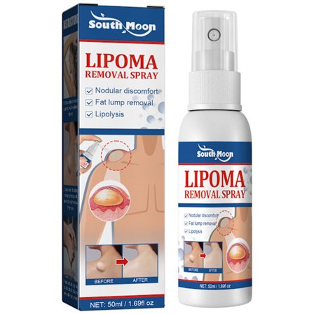 Lipomaborttagningsspray för kroppens subkutana lipomlera, milda växtbaserade ingredienser, spray
