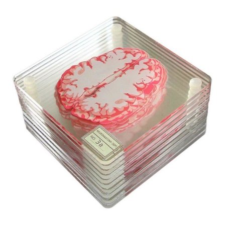 Hjerne Prøve Glasbrikker Sæt 3D Organ Hjernekunst Hjerne Skiver Firkantede Akryl Drikke Bord Glasbrikker