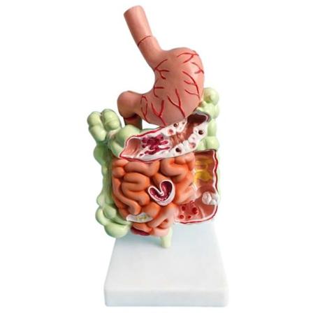 Ihmisen ruoansulatusj rjestelm n malli Vatsan anatomia Paksusuoli Umpisuoli Per suoli Duodenum Ihmisen sis elinten rakennemalli