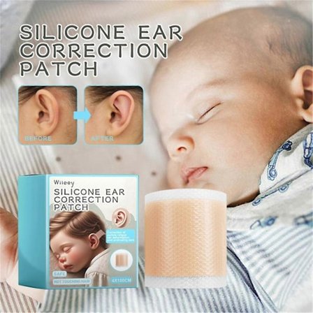Baby Myk Pustende Silikon Ørekorrigerende Tape Baby Auricle Valgus Korreksjonslapp For Barn Spedbarn Baby Ørekorreksjon
