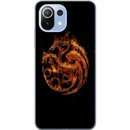 Xiaomi 11 Lite 5g Ne Mjukt Skal - House Of The Dragon