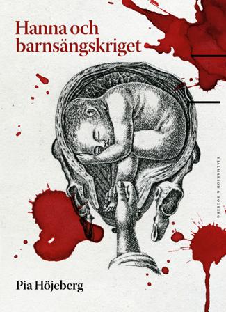 Hanna och barnsängskriget - Bok av Pia Höjeberg - Inbunden