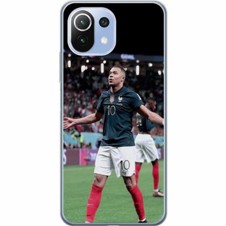 Xiaomi Mi 11 Lite Skal / Mobilskal - Mbappe