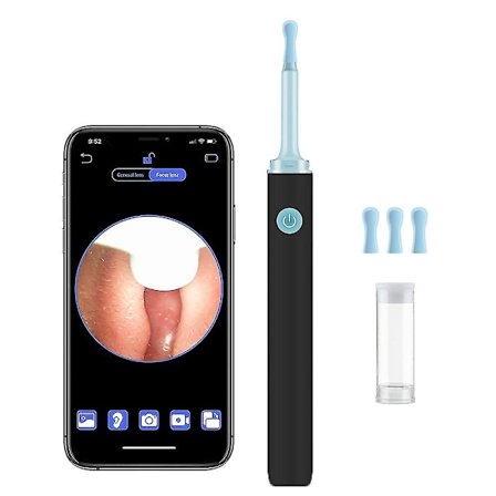 Multifunktionell Smart Ear Cleaner Earpick 500w Pixel Hd Ear Endoscope Camera Earwax Remover Tool Set