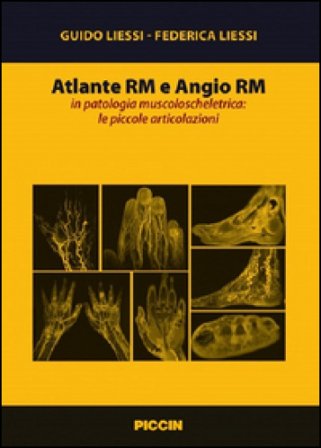Atlante RM e angio RM in patologia muscoloscheletrica: le piccole articolazioni Guido Liessi