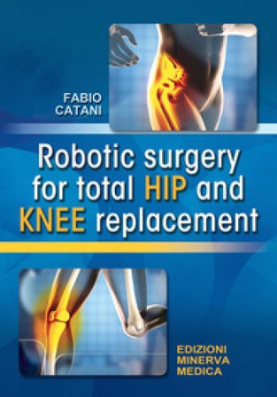 Robotic surgery for total hip and knee replacement Fabio Catani