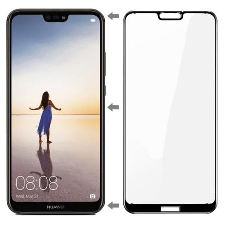 MyGuard Carbon Model näytönsuoja Huawei P20 Lite -puhelimelle Svart