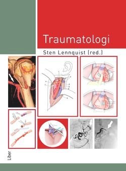 Traumatologi