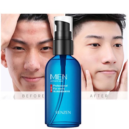 50 ml Arbutin Anti-rynke Serum for Menn Oljekontroll Forminsker Porer Essens Lysner Bleking Hyaluronsyre Fuktighetsgivende Ansiktspleie