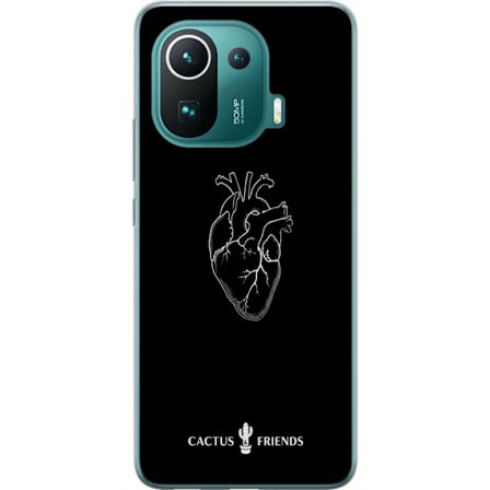 Kompatibel Mobilcover til Xiaomi Xiaomi Mi 11 Pro Kaktus og Venner - Midnat Anatomi Hjerte