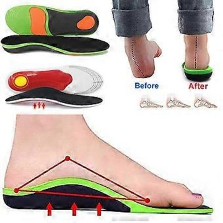 Ortopediska inlägg Stöd för fotvalv Plattfot Hälsmärta Plantar Fasciit