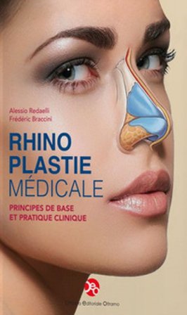 Rhinoplastie médicale. Principes de base et pratique clinique Frédéric Braccini