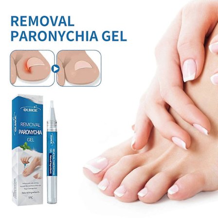 Harmaa kynsien korjausgeeli, korjaa kynsivako, paksuuntava kynsienhoito harmaa kynsilakkakynä