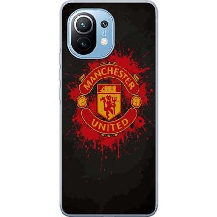 Kompatibelt Mobildeksel til Xiaomi Xiaomi Mi 11 Manchester United logo i rød og gul farge med røff sportslig bakgrunn