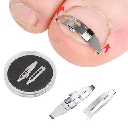 Pedikyyri Recover Embed Toe Nail Corrector -hoitotyökalut jalkaan