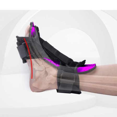 IC Plantar Fasciit Nattskena, Fotledsstöd för Immobilisering