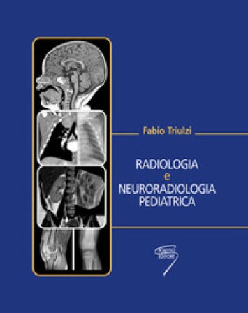 Radiologia e neuroradiologia pediatrica Fabio Triulzi