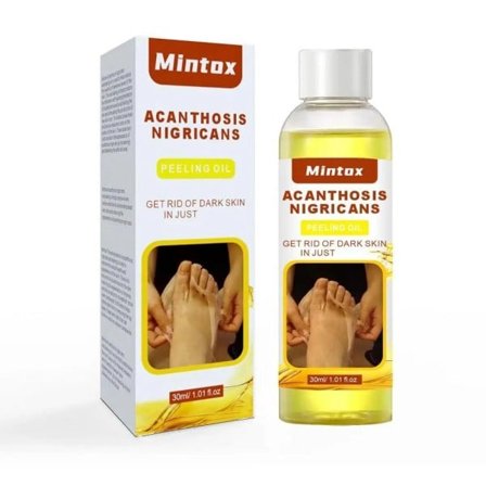 30ml Peeling Olja Armbåge Knä Finger Svart Gul Olja För Hud Ljusning Fuktgivande Tar bort Döda