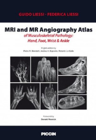 MRI and MR angiography atlas of musculoskeletal pathology: hand, foot, wrist & ankle Guido Liessi